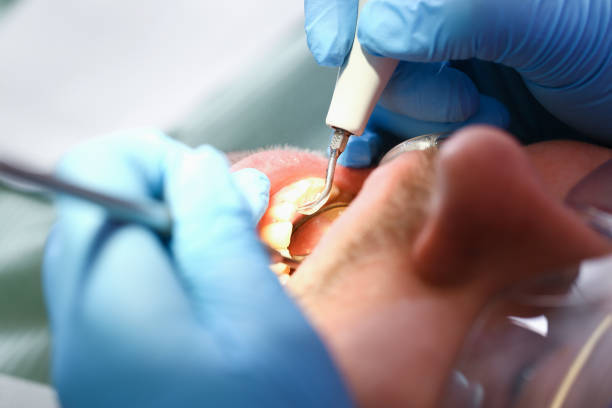 Best Dentist for Dental Trauma  in Houston, MS